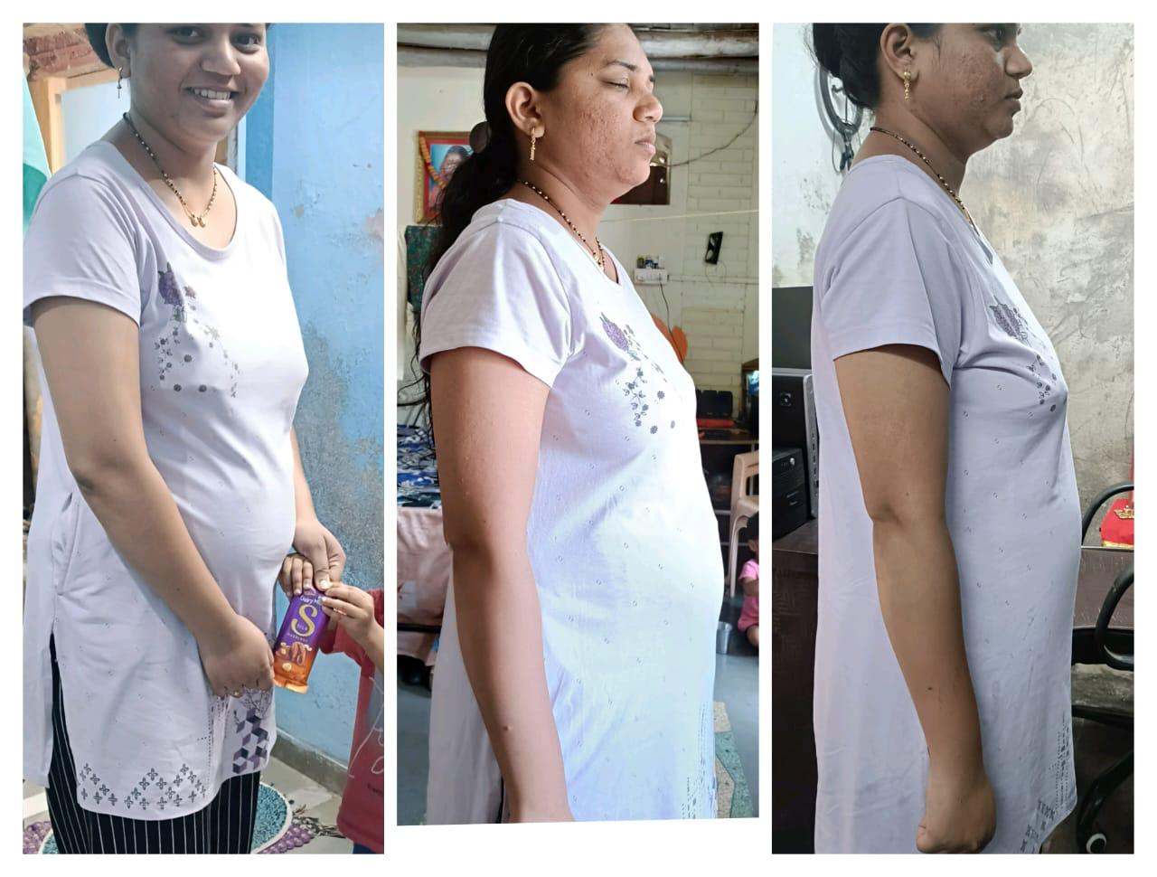 Transformation 4